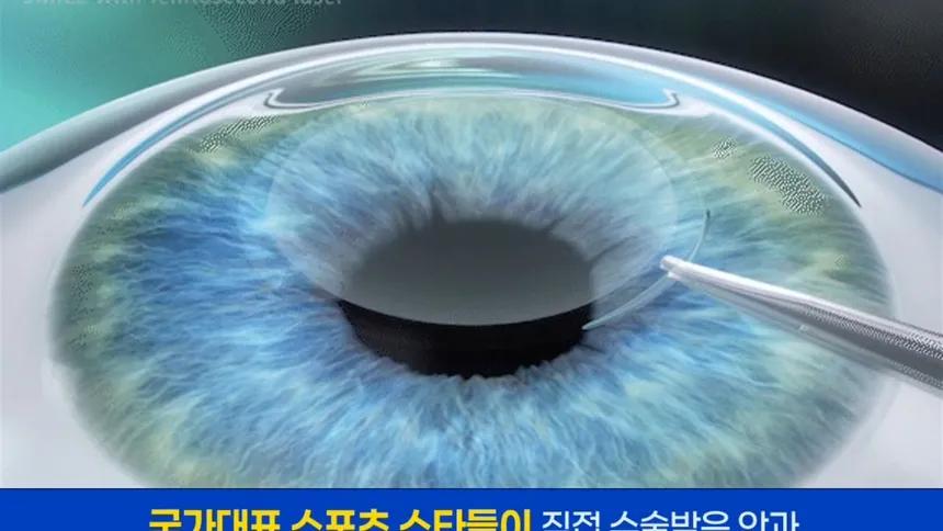 비용 부담없는 스마일라식