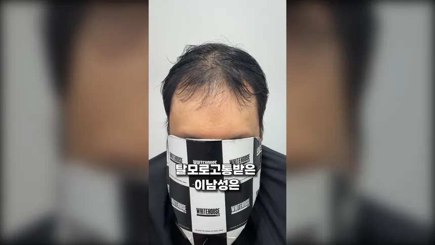 탈모 극복! 화이트하우스 인천점 헤어 변신 과정