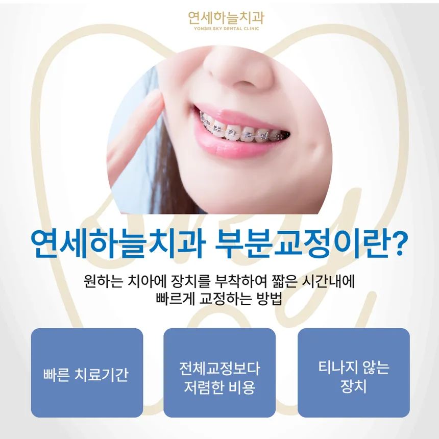 연세하늘치과 부분교정 홍보 이미지