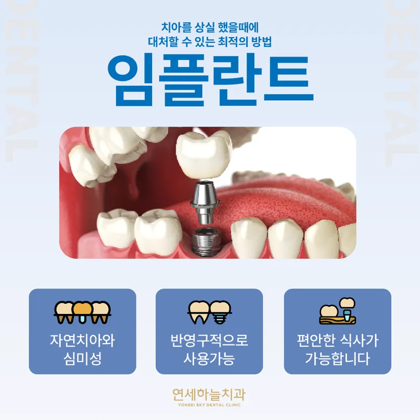 연세하늘치과 임플란트 포트폴리오