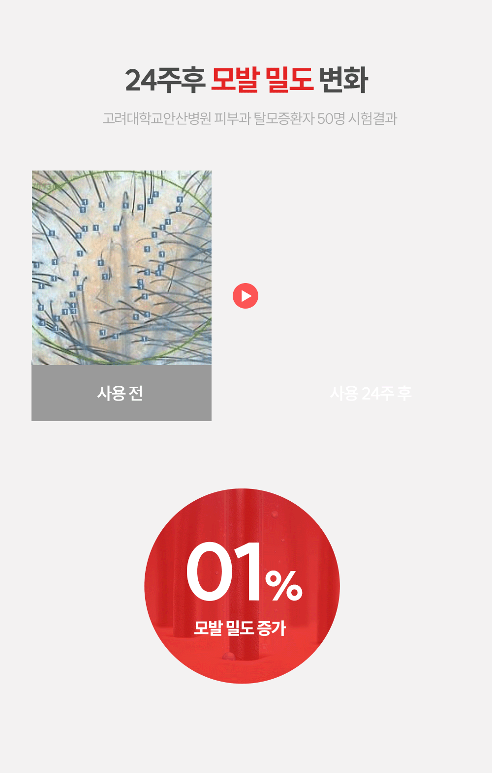 탈모샴푸 광고 소재 디자인 포트폴리오
